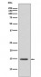 Anti-Histone H3 (acetyl K14) HIST1H3A Rabbit Monoclonal Antibody